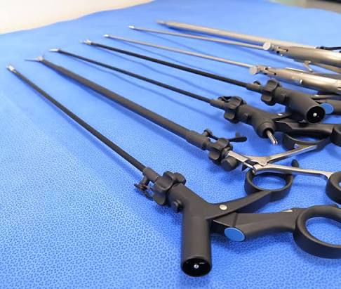 Cholecystectomy